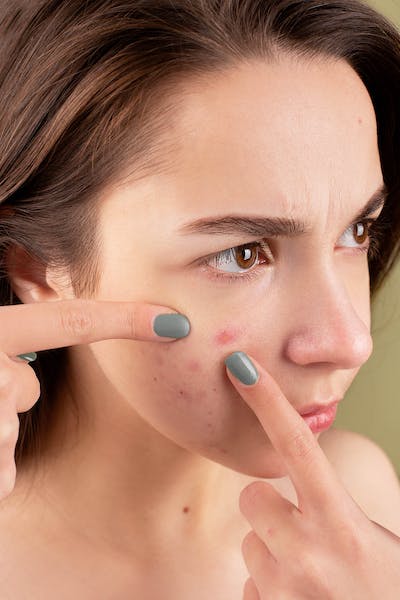 Comprehensive Guide to Effective Skin Care Treatments